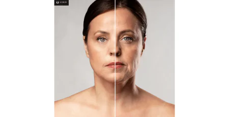 How to Avoid Ozempic Face Essential Tips & Prevention Strategies