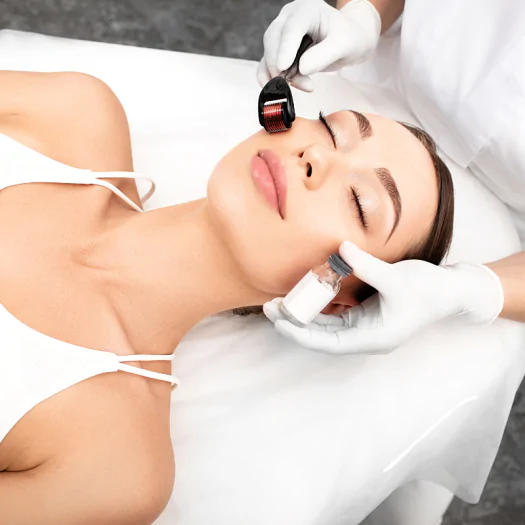 Microneedling for Acne Scars: How It Works & What to Expect