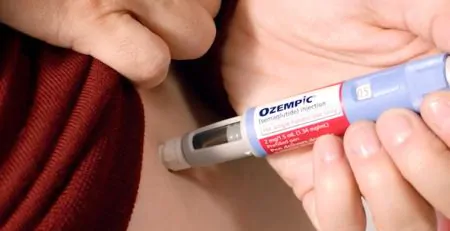 Top 5 Ozempic Myths Addressed by Medical Experts