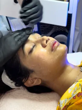 HydraFacial at LA ViE MD – Deep Cleanse, Hydrate & Glow