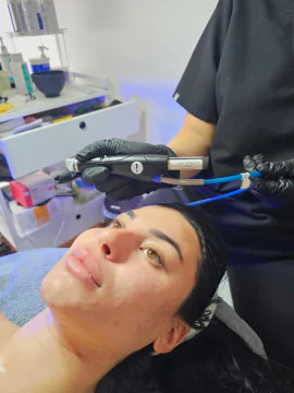HydraFacial at LA ViE MD – Deep Cleanse, Hydrate & Glow